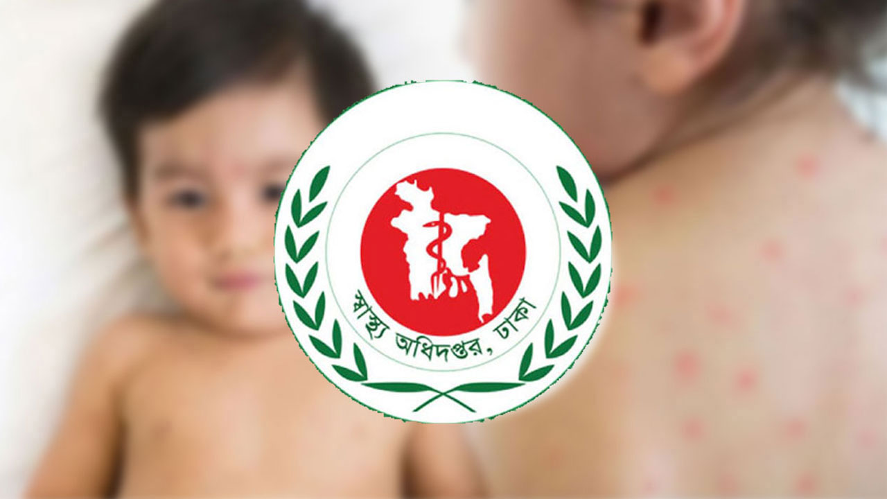 দেশে হাম ও উপসর্গে আরও ৯ শিশুর মৃত্যু