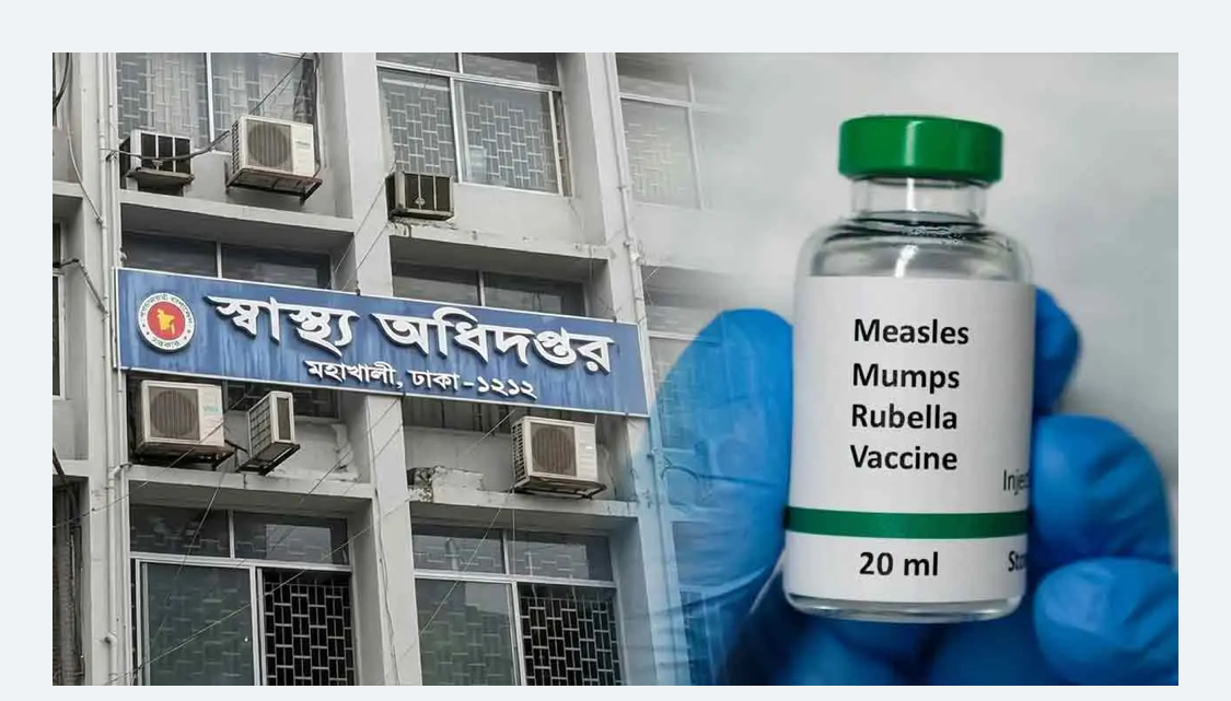 হাম ও হামের উপসর্গ নিয়ে আরও ১১ শিশুর মৃত্যু