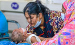 ছুটিতে হাম উপসর্গে ৫৭ শিশুর মৃত্যু