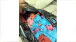 পলিথিনে মোড়ানো কন্যাশিশু হাসপাতালে চিকিৎসাধীন