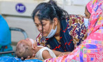 হাম উপসর্গে আরো ২ শিশুর মৃত্যু